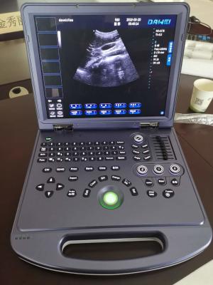 China El sistema de diagnóstico ultrasónico portátil 4d del CE colorea el ultrasonido 300m m de Doppler en venta