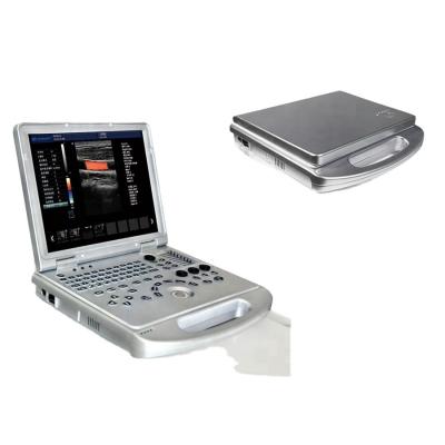 China GH-L5 Portable Ultrasound Machine  4d Diagnostic Ultrasound Pregnancy Machine for sale
