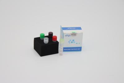 China HBV HCV Real Time PCR Detection Kit PCR Amplification Kit 20uL Reaction Volume for sale