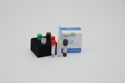China Laboratory Multiplex Fast Real Time RT PCR Detection Kit Reagents For Sars Virus Detection for sale