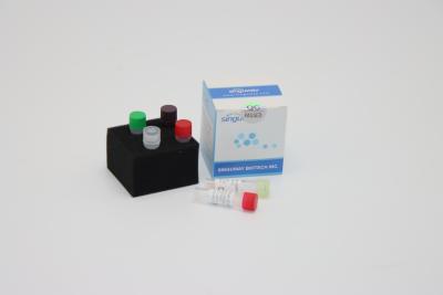 China Ultrafast Rabies Virus DNA PCR Detection Kit Reagents Required For PCR for sale