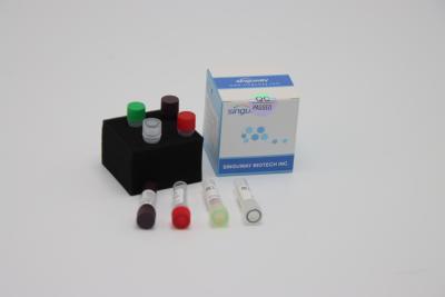 China Avian Influenza Virus RT PCR Testing Kit 48 96 Tests Nasal Swab Test Kit for sale