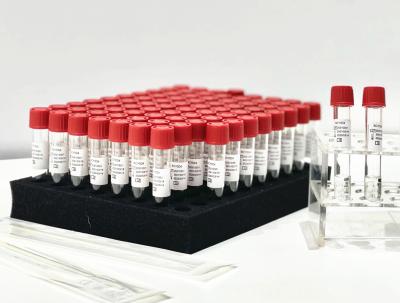 China Uma extração Kit From Patient Pharynx Swab do PCR do reagente da liberação da amostra da etapa à venda