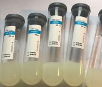 Quality PRP Gel Trinder Reagent For Facial Skin Rich In High Concentration Platelets for sale