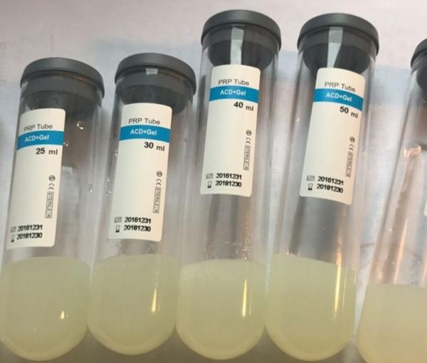 Quality PRP Tube Serum Separator Gel Platelet Rich Plasma Gel Accurate Customized for sale