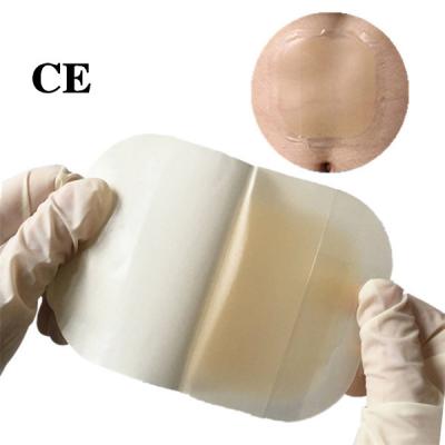China CE EN13485 ISO Surgical Transparent Wound Dressing Waterproof for sale