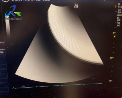 China GE Logiq S6 Ultrasound Machine Repair Displays Virtual Plot And No Echo Zone for sale