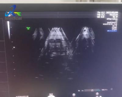 China GE Voluson E8 Conserto de máquina de ultrassom Imagens anormais de ultrassom Substitua placa Rfm à venda