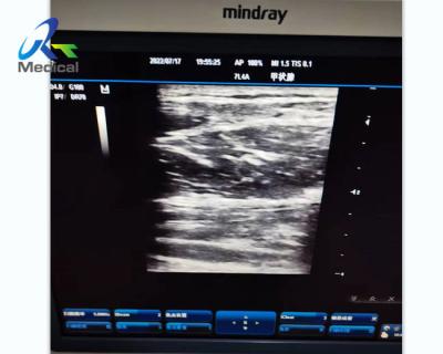 China Abnormal Image Ultrasound Machine Repair Service Mindray DC-3 for sale