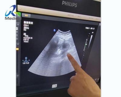 China EPIQ 5 Ultrasound Machine Repair Dark Channels In The Sound Area Replace ACQ for sale