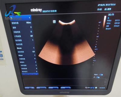 China Doppler Ultrasound Machine Repair Solutions Mindray DC-70 Dark Shadows In The Image Of The Echo Zone for sale
