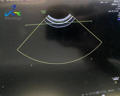China GE RIC6-12-D Sonda de ultrasonido usada 3D 4D Intra Cavity Voluson E8 Transductor de ultrasonido médico en venta