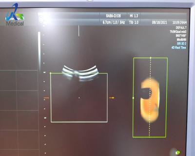 China imagem anormal do transdutor de GE RAB-6-D do reparo da ponta de prova do ultrassom 3D com bolha de ar à venda