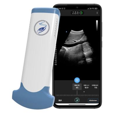 China CE Marked 3.6MHz Portable Wifi Ultrasound Scanners JPEG BMP PNG MPEG-4 for sale
