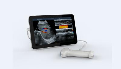 Chine haute fréquence tenue dans la main portative de scanner d'ultrason de la double tête 5V à vendre