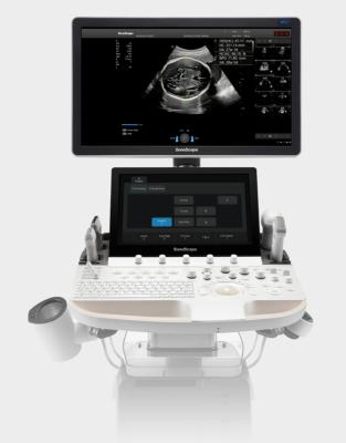China Artificial Intelligence Based SonoScape Ultrasound Machine Trolley P60 Exp for sale