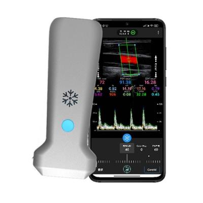 China WiFi 12.6cm Remote Portable Doppler Ultrasound Machine 30 Fps for sale