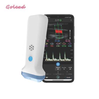 China 12MHz 3000mAh Wireless Probe Type Ultrasound Scanner For Iphone for sale