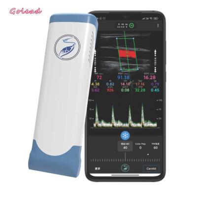 China Electronic Linear Array Wifi Wireless Portable Ultrasound Scanner 12MHz for sale