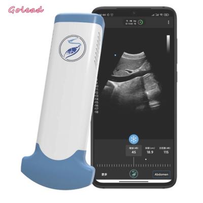 China Electronic Convex Array Wireless Ultrasound Device For Mobile Phone for sale