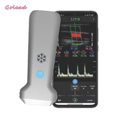 Cina 126mm Convex Probe Ultrasound Scanner For Vascular MSK Nerve in vendita