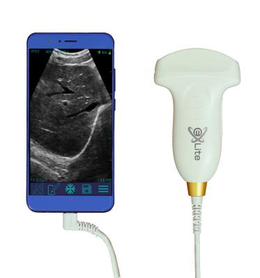 China Electronic Convex Array Color Doppler Handheld Ultrasound Scanner 3.5MHz for sale