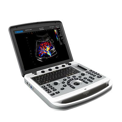 China 120° Rotatable Chison SonoBook 6 Portable Laptop Ultrasound Machine for sale