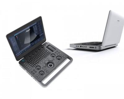 Китай Умный завизируйте машину ультразвука SonoScape ноутбука 500GB с 15,6» LCD продается