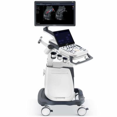 China 500GB Spatial Compound Imaging SonoScape Ultrasound Machine P25 for sale