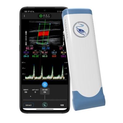China Echo Color Doppler Wireless Handheld Ultrasound Scanner 100 Frames for sale