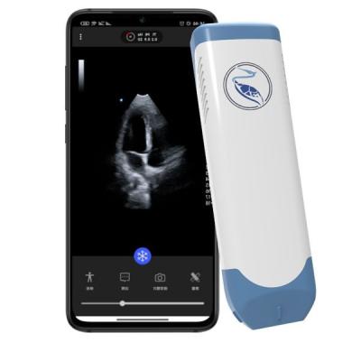 China Escáner del ultrasonido del PDA de la profundidad el 18.9cm para Iphone 3.6MHz en venta