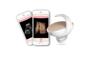 China 60 Degree 3D 4D Handheld Ultrasound Scanner Fetus Camera M1 4.0MHz for sale