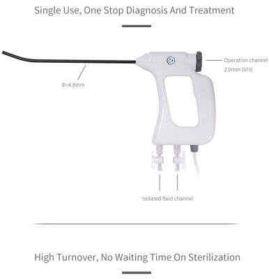 China 4.8mm Hysteroscopy descartável eletrônico que evita o ângulo de visão transversal da infecção 100° à venda