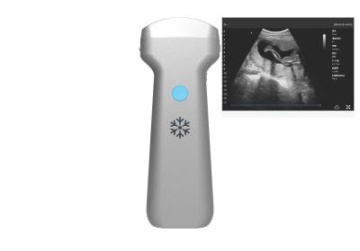 China Electronic Convex Array Convex Wireless Ultrasound Probe 2MHz 3.6MHz 5MHz for sale