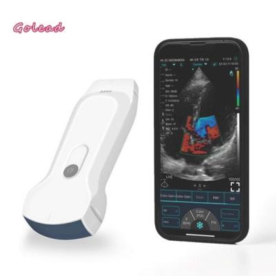 Cina 3 in 1 Wireless Ultrasound Probe with 8 Adjustment TGC WiFi Connection in vendita