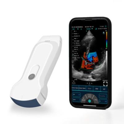 China Portable IPad Wireless Ultrasound Probe For Clinical Diagnosis for sale
