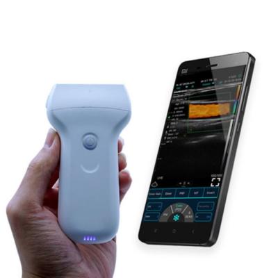 China 96 Element Wireless Ultrasound Probe Mobile Ultrasound Scanner Te koop