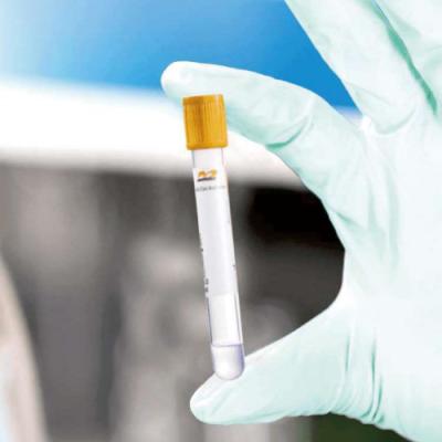 China Tubo estéril da coleção do sangue do vácuo da amostra grátis à venda