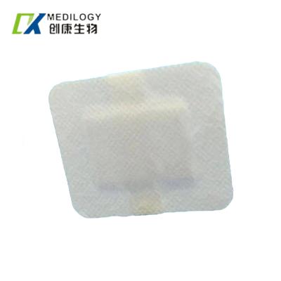 China Non Woven PU Film Dressing Release Paper Sterile Adhesive Dressing en venta