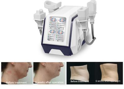 China Portable 360 Cryolipolysis Body Slimming Machine 1000W For Fat Burning Weight Loss for sale