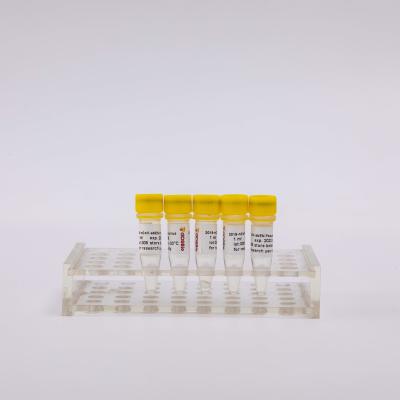 China 2019-NCoV-AbEN Pseudovirus 1ml Nucleic Acid Extraction Kit for sale