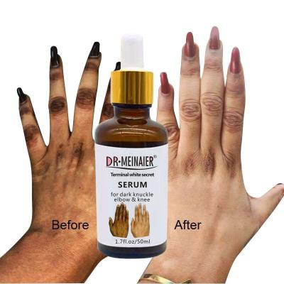 China GMPC Bodycare Cosmetics Whitening Hand Knuckle Glow Serum For Removing Dark Knuckle Elbow for sale