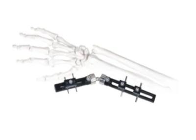 China Straight Pin Type Wrist Medical External Fixator minimal interference with soft-tissue for sale