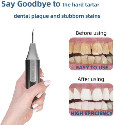 China Cámara dental ultrasónica eléctrica de Sonic Oral Care Product With Wifi del limpiador en venta