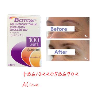 China Alternder Antifalten-Botulinumantigiftstoff Allergan schreiben ein Botox-Pulver zu verkaufen