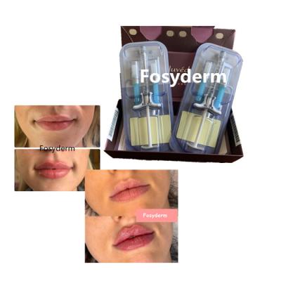 Chine La croix de remplisseur de lèvres d'acide hyaluronique de volbella de Juvederm a lié 24mg à vendre