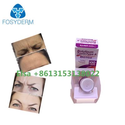 China Botulinum Toxin Type A Botoxs Dermal Filler Anti Wrinkle Face Injectable for sale