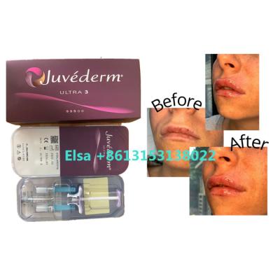 China Llenador cutáneo de Juvederm de los productos cosméticos para los labios de la cara en venta