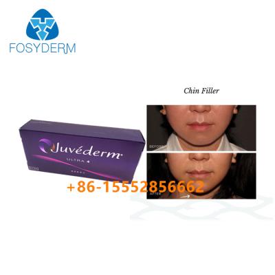 China Llenador Juvederm Ultra4 2ml cutáneo de Chin Augmentation Hyaluronic Acid Facial en venta