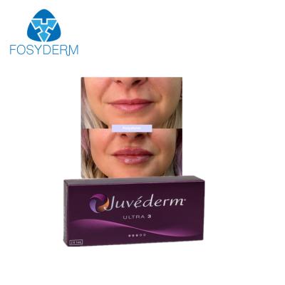 中国 Juvederm Ultra3の皮膚唇の注入口の十字によってつながれる唇の強化のHyaluronic酸 販売のため